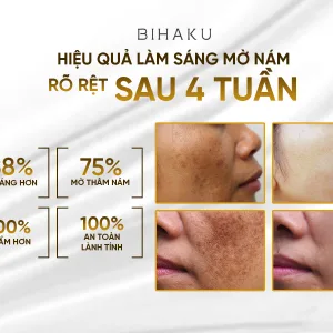 Combo Duong Trang Mo Nam Bihaku hieu qua ro ret sau 4 tuan