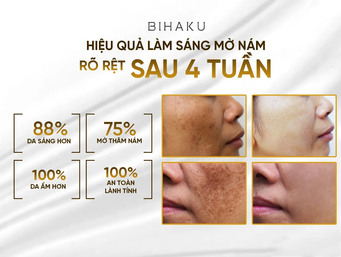 Combo GIẢM NÁM DƯỠNG TRẮNG BIHAKU - Image 2