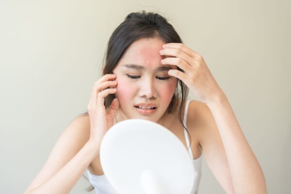 Da Nhạy Cảm Là Gì