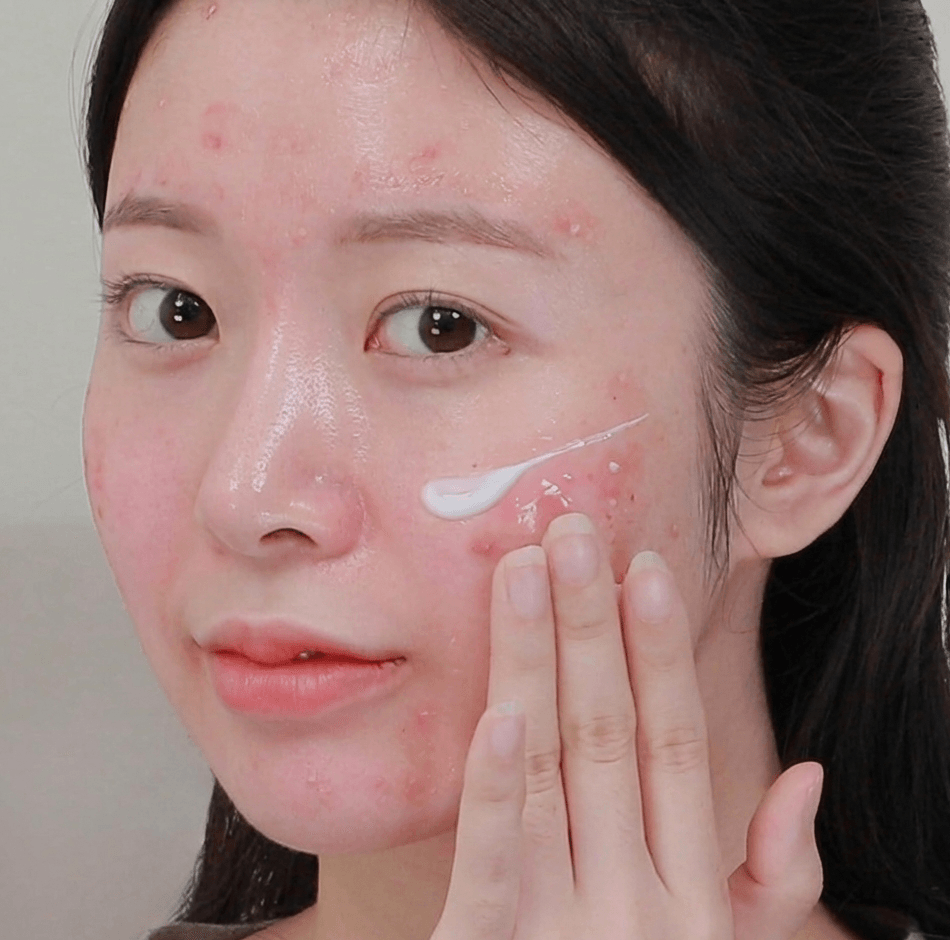 Da nhạy cảm do dị ứng