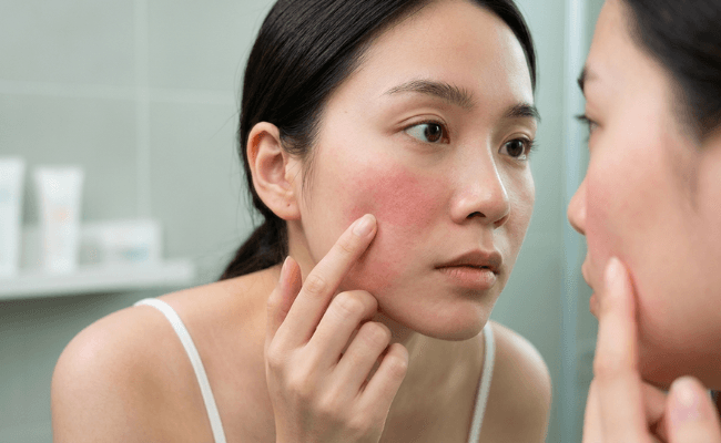 Da nhạy cảm càng cần chống nắng tốt