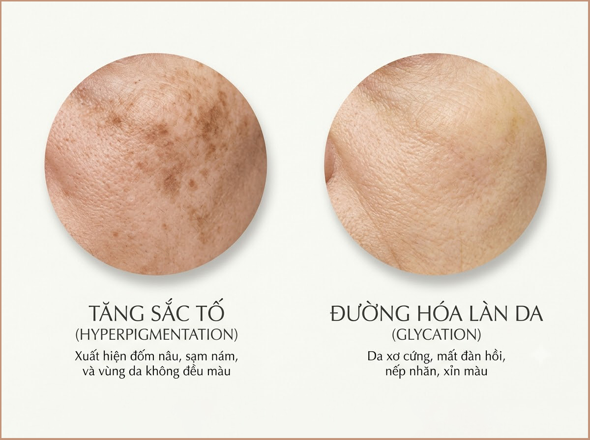 Da vàng sạm theo tuổi tác: Phân biệt tăng sắc tố Melanin và hiện tượng đường hóa da 3 Phân biệt tăng sắc tố và đường hóa da